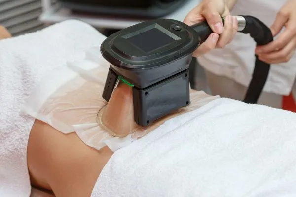 Image of person having fat freezing treatment to help weight gain Harlow