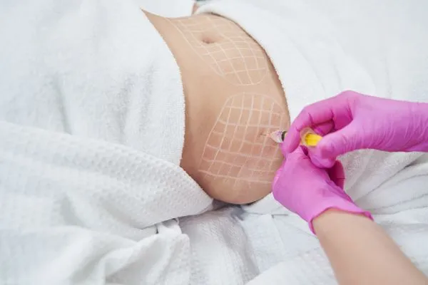 image of fat dissolving injections on love handles to help combat weight gain Harlow