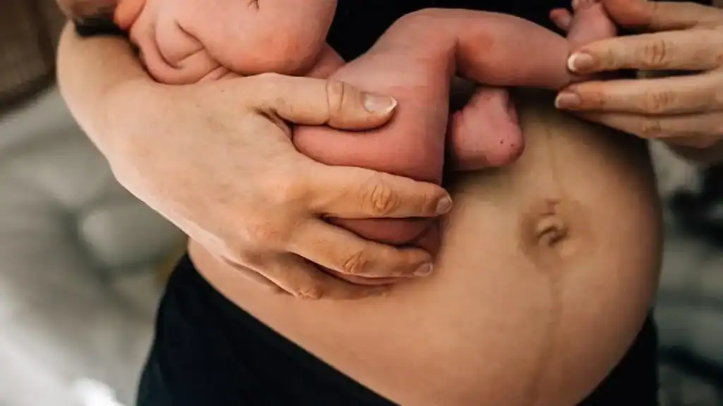 Why Is My Stomach Still Big After Pregnancy Harlow?